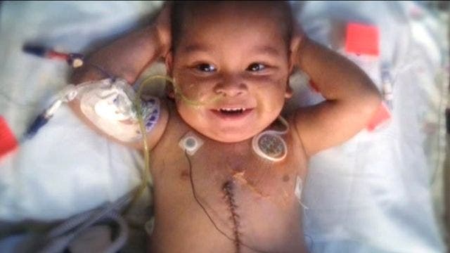 121813 edge transplant2 640 3 year old Tampa boy survives rare 5 organ transplant